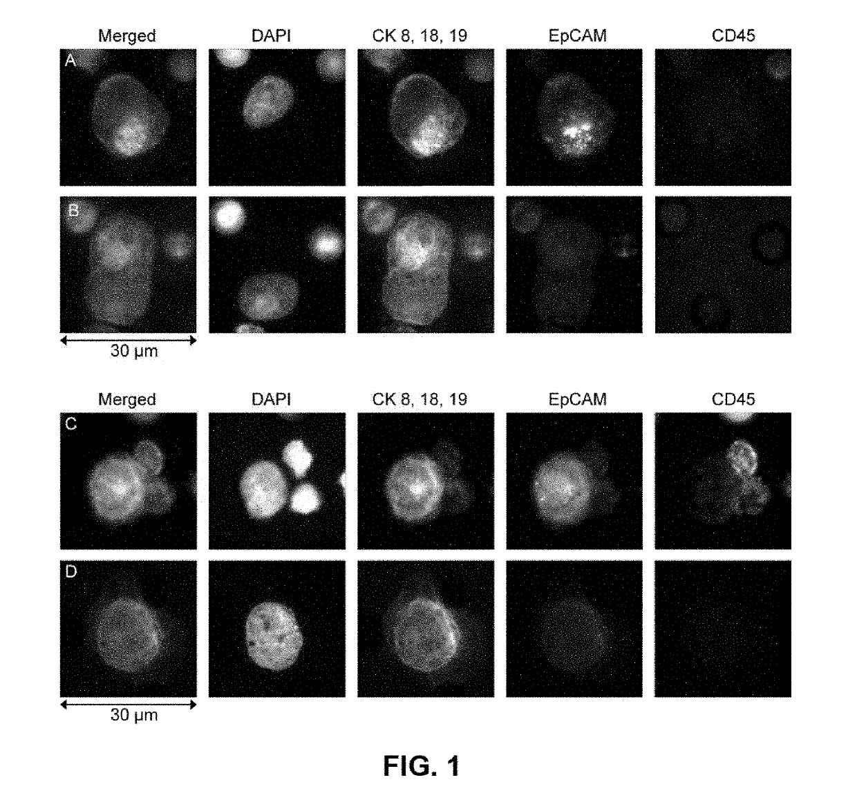 Capture, identification and use of a new biomarker of solid tumors in body fluids