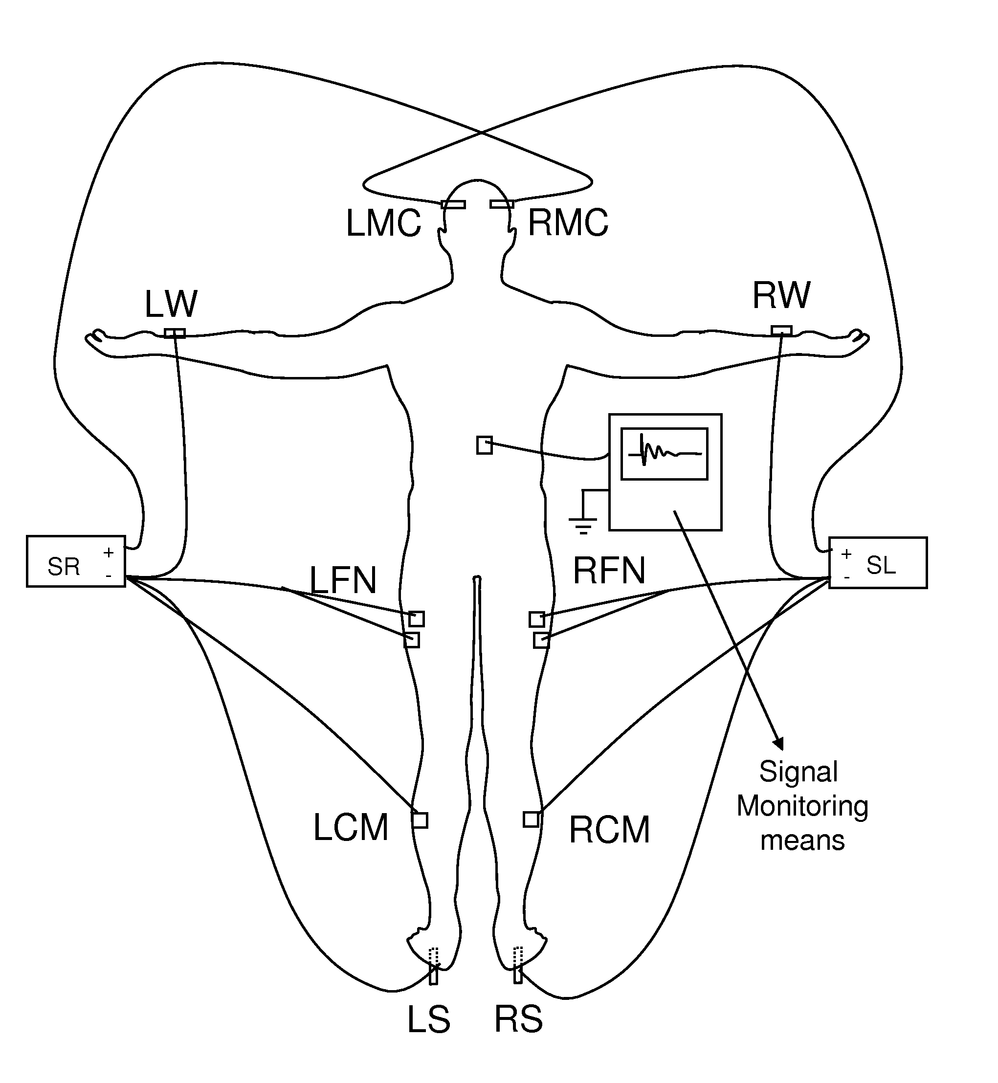 Charge-enhanced neural electric stimulation system