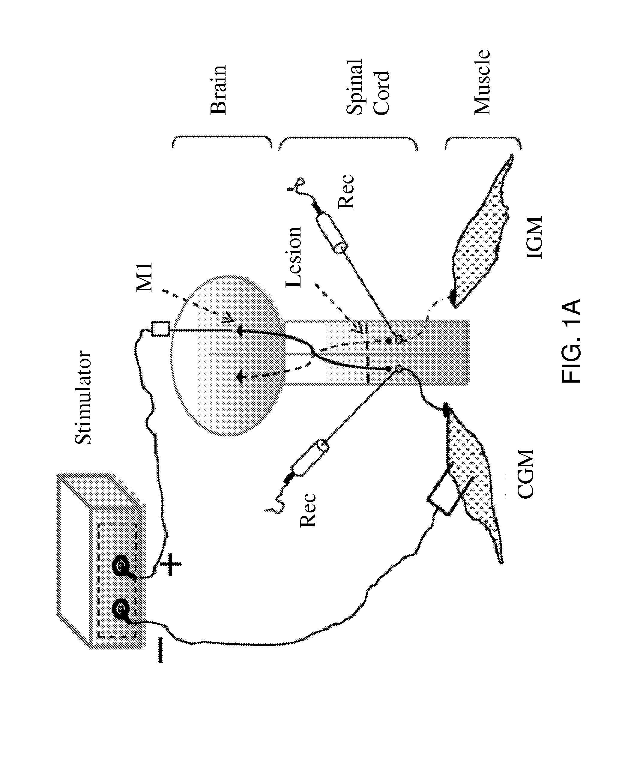 Charge-enhanced neural electric stimulation system