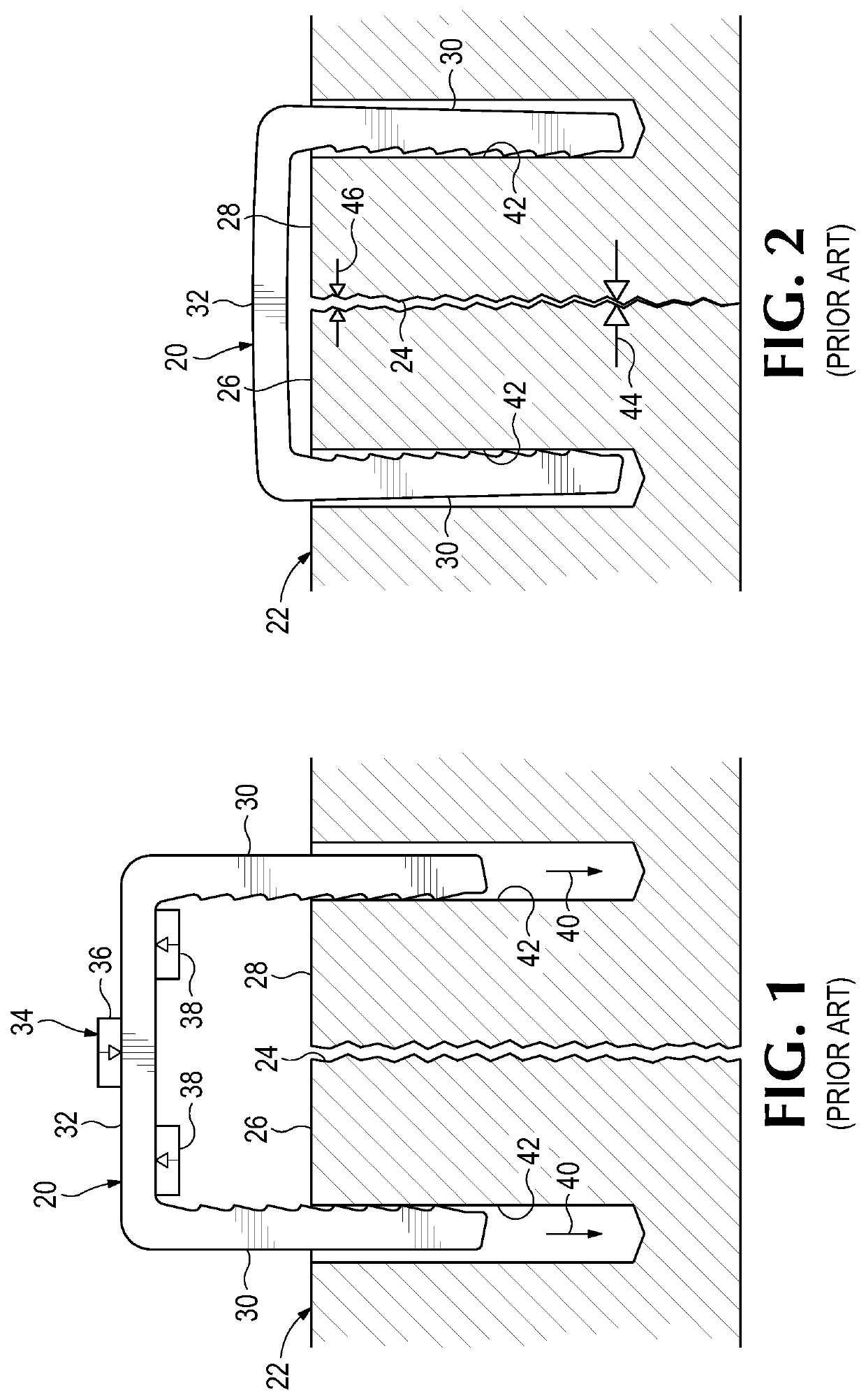 Bone clip with resilient arm for proximal compression