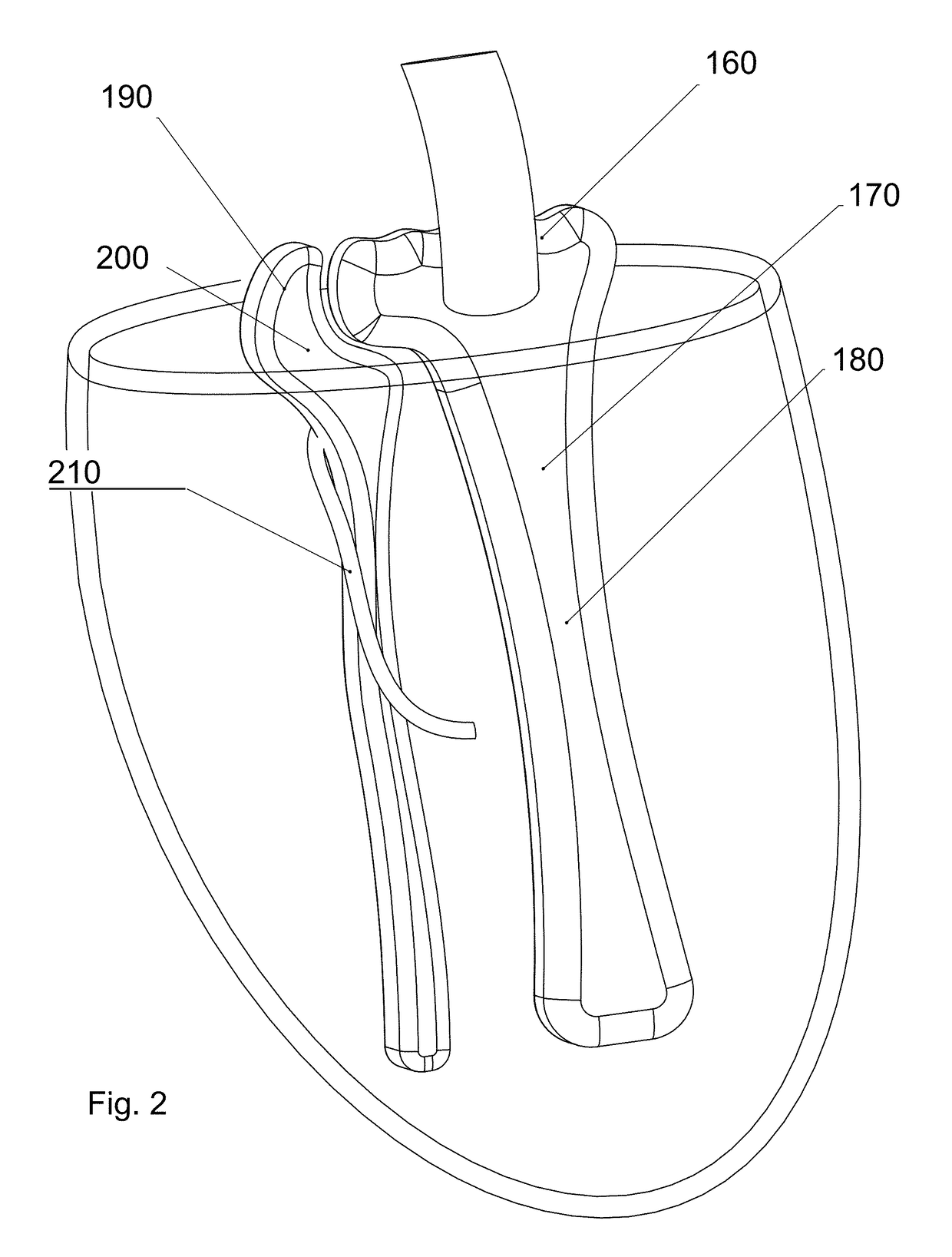 Knit Prosthetic Liner Textile With Differentiated Knit Fabric Exterior