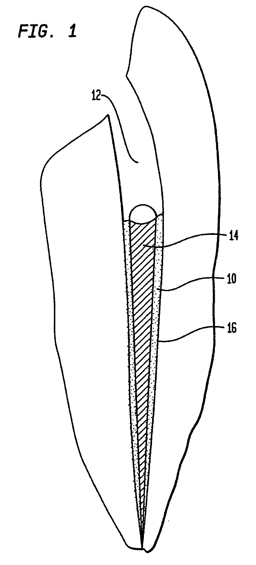 Epoxy based oil free root canal sealer