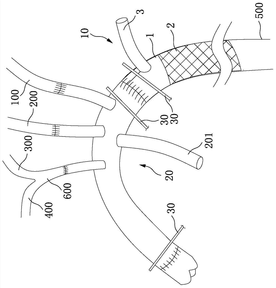 Perfused distal-end artificial blood vessel with stent and artificial blood vessel for descending part of arcus aortae