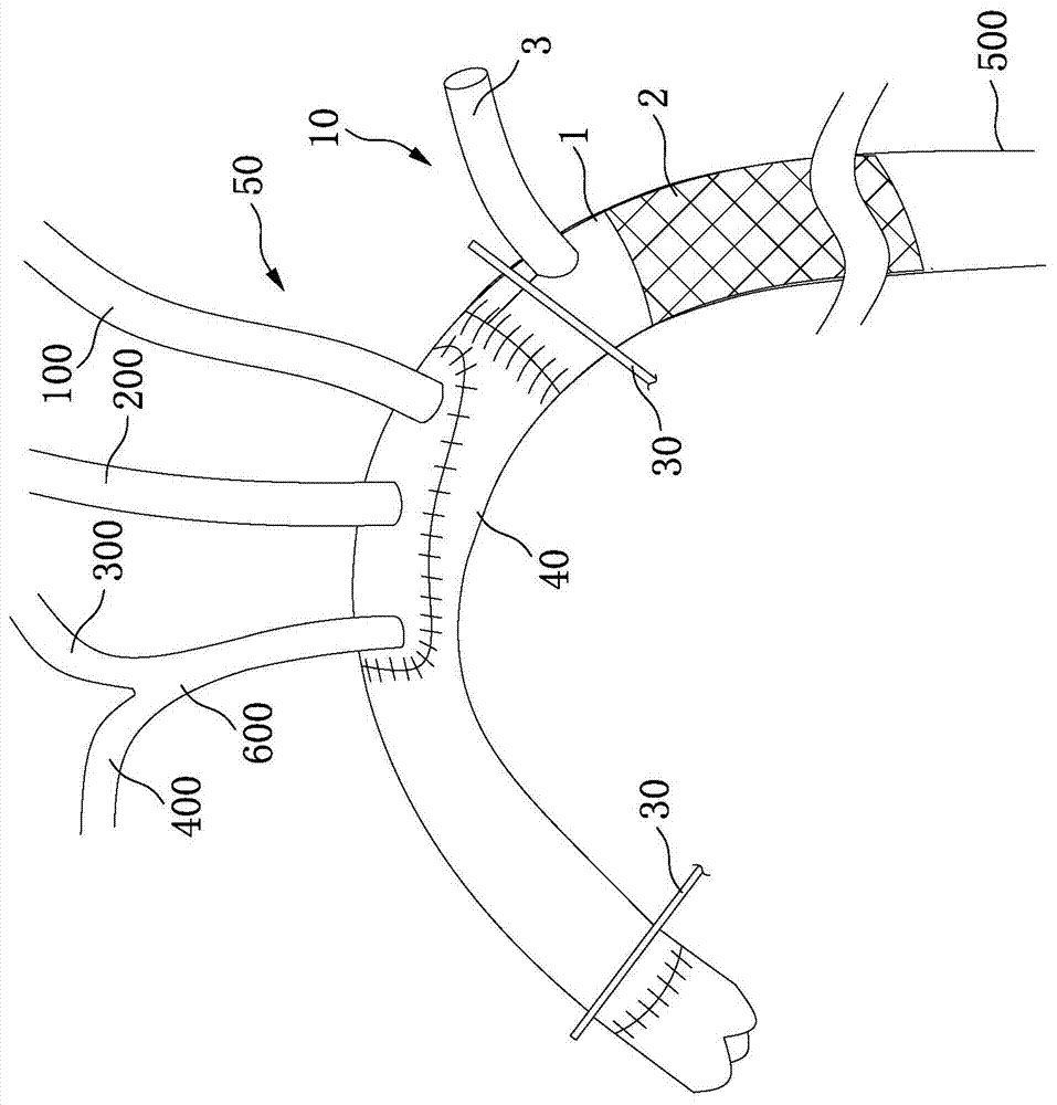 Perfused distal-end artificial blood vessel with stent and artificial blood vessel for descending part of arcus aortae