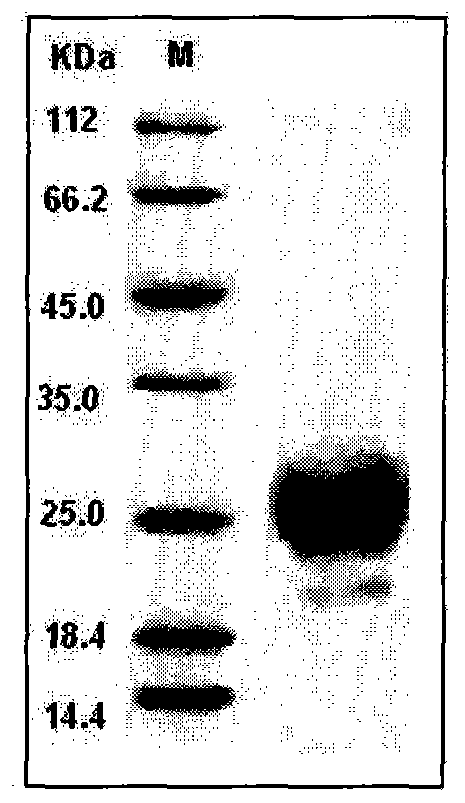 Enzyme linked immunosorbent assay kit for detecting human epididymis secretory protein 4