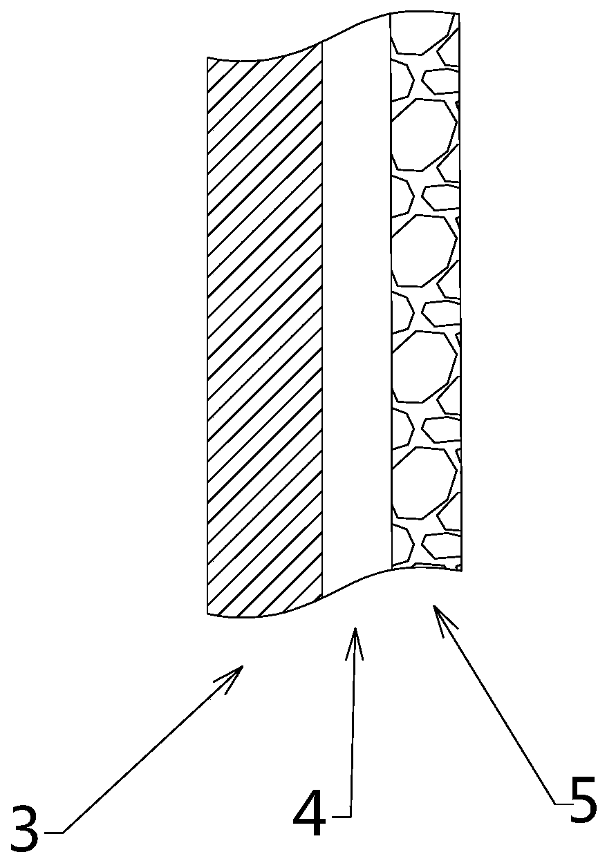 Joint Replacement Prosthesis