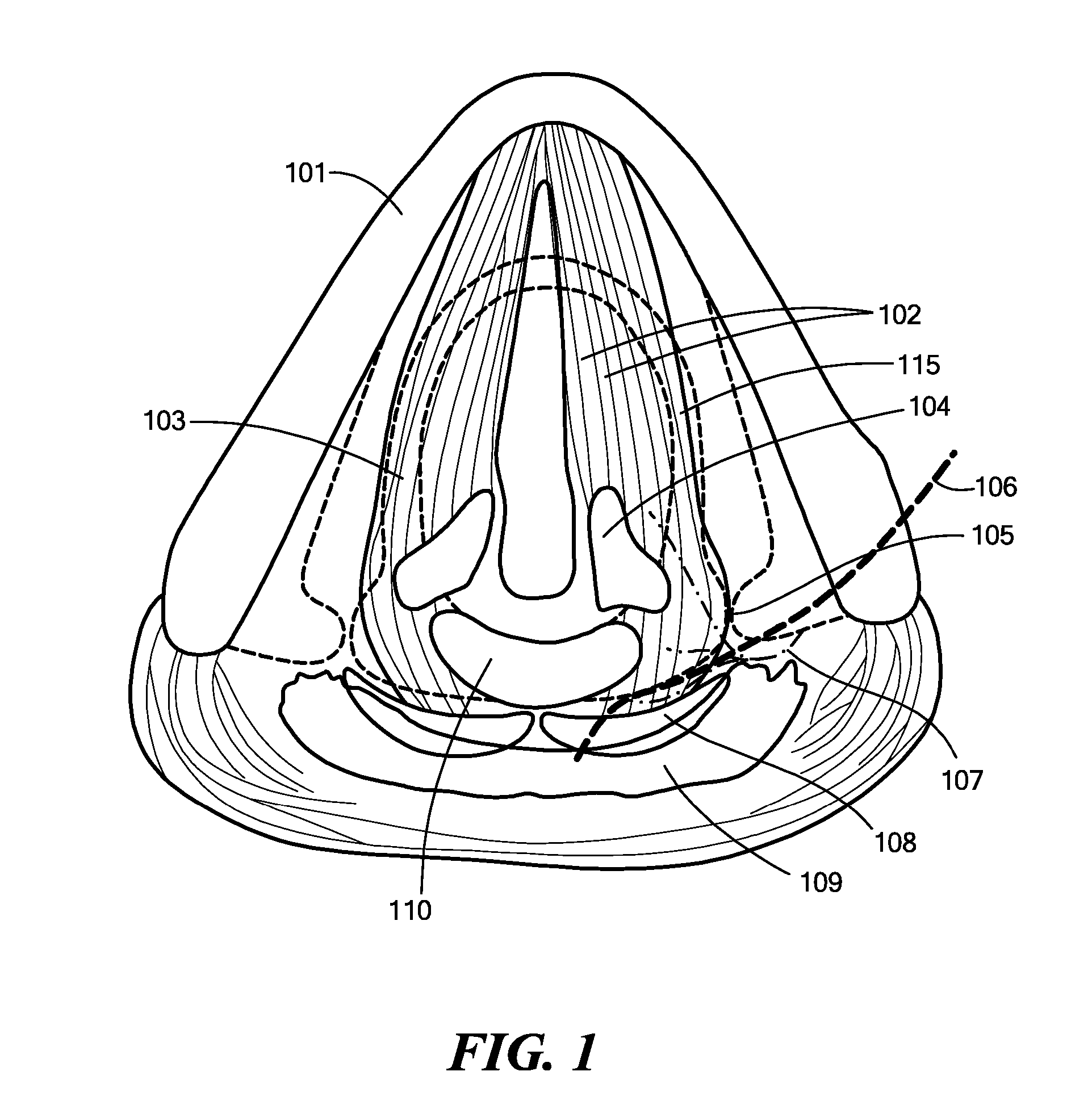 System, Apparatus, and Method for Facilitating Interface with Laryngeal Structures