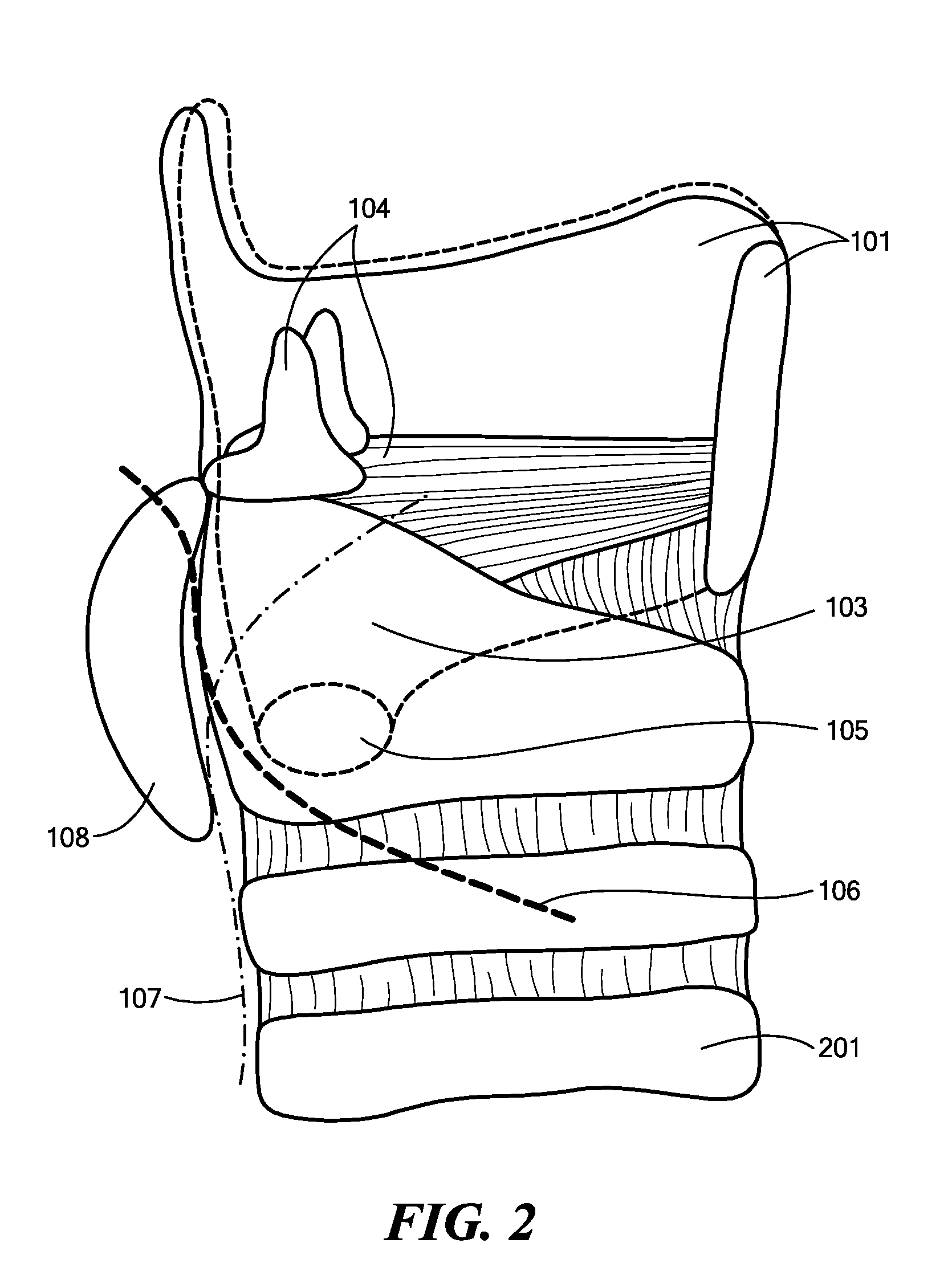 System, Apparatus, and Method for Facilitating Interface with Laryngeal Structures