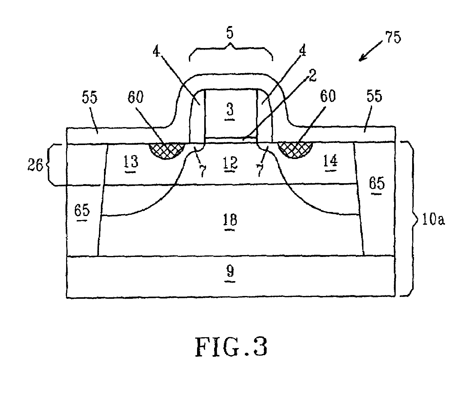 Strained-silicon CMOS device and method