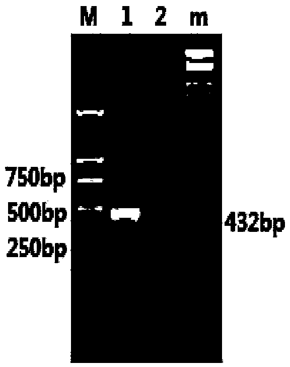 Tuberculosis protein, and preparation and application thereof