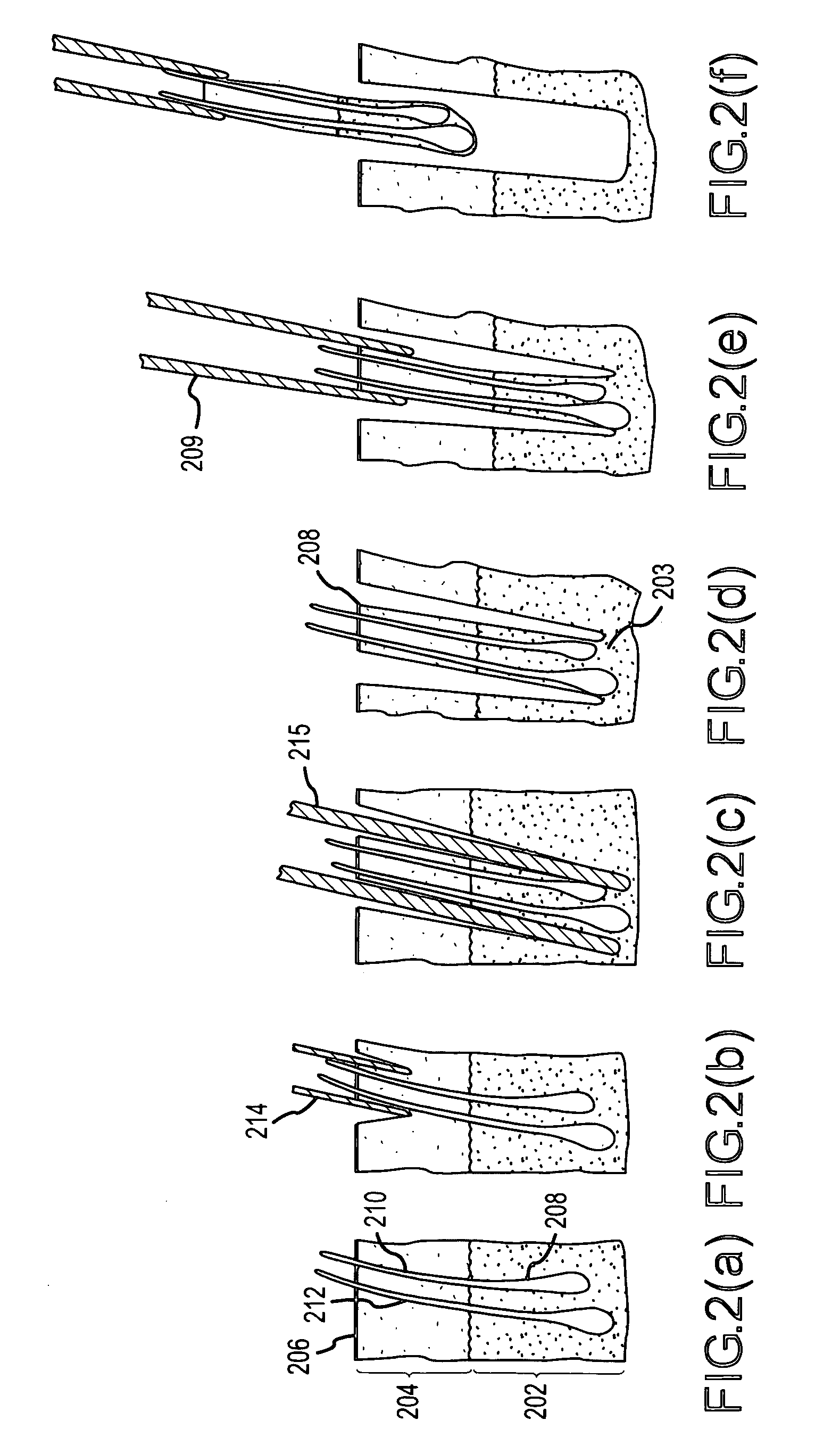 Follicular extraction method and device