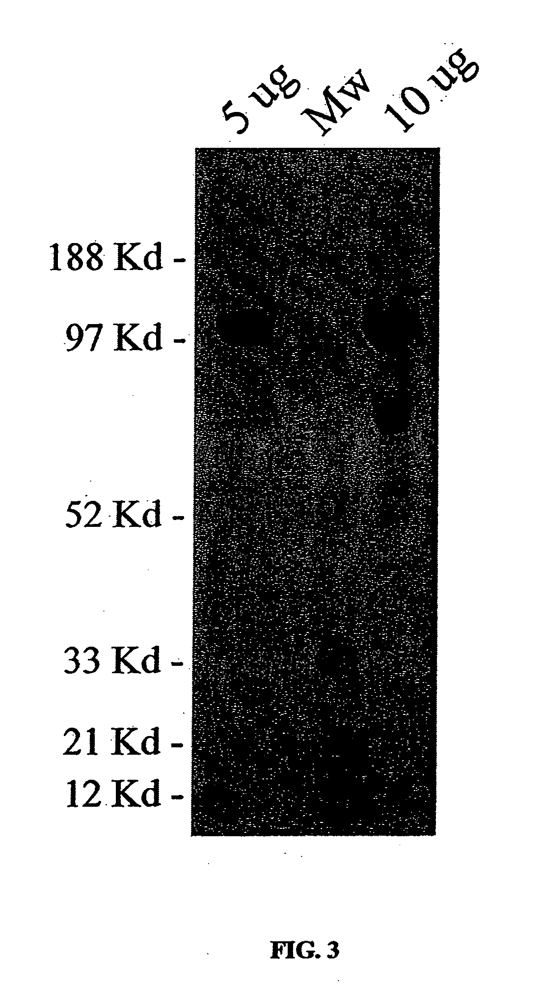 Method of treatment of endothelial dysfunction and engineered proteins for same