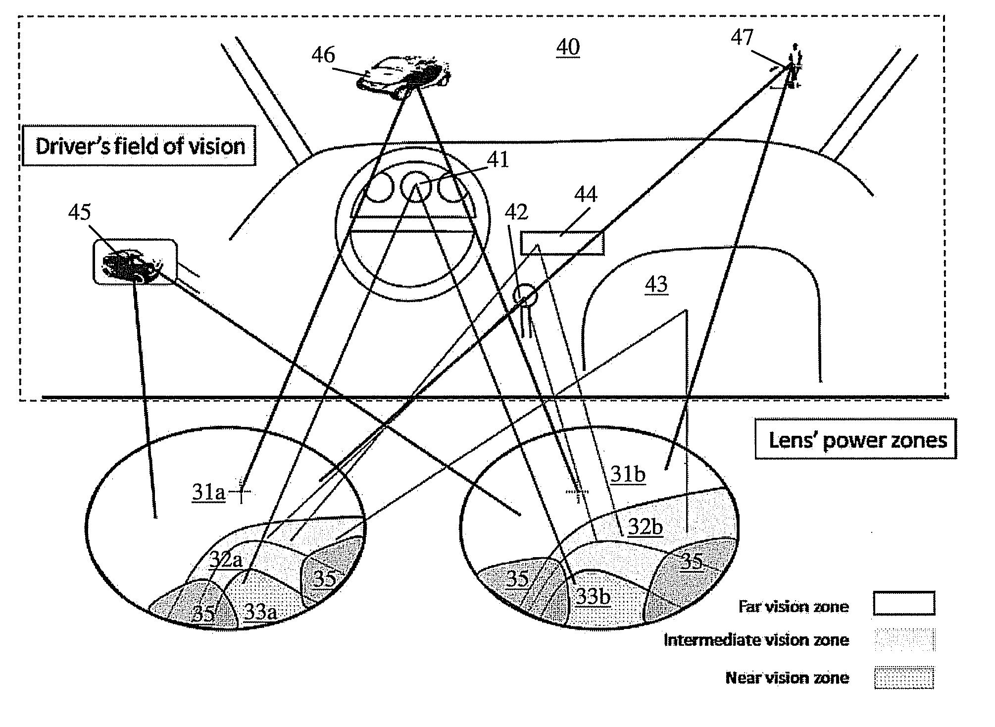 Assymetrical progressive lens