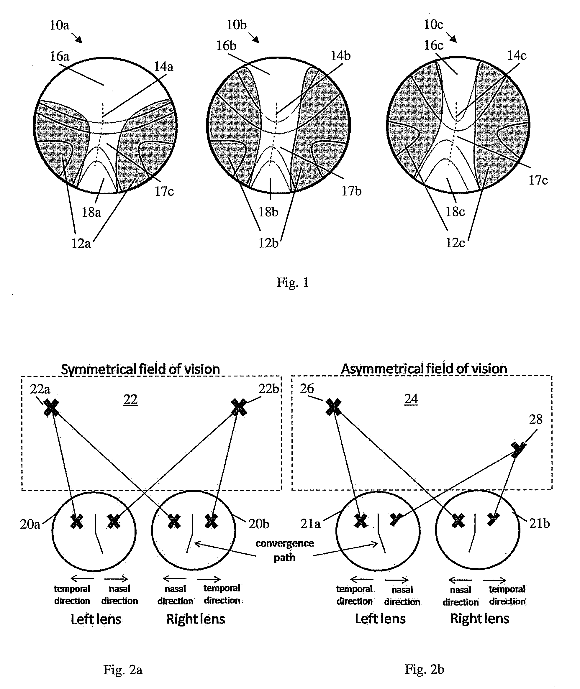 Assymetrical progressive lens