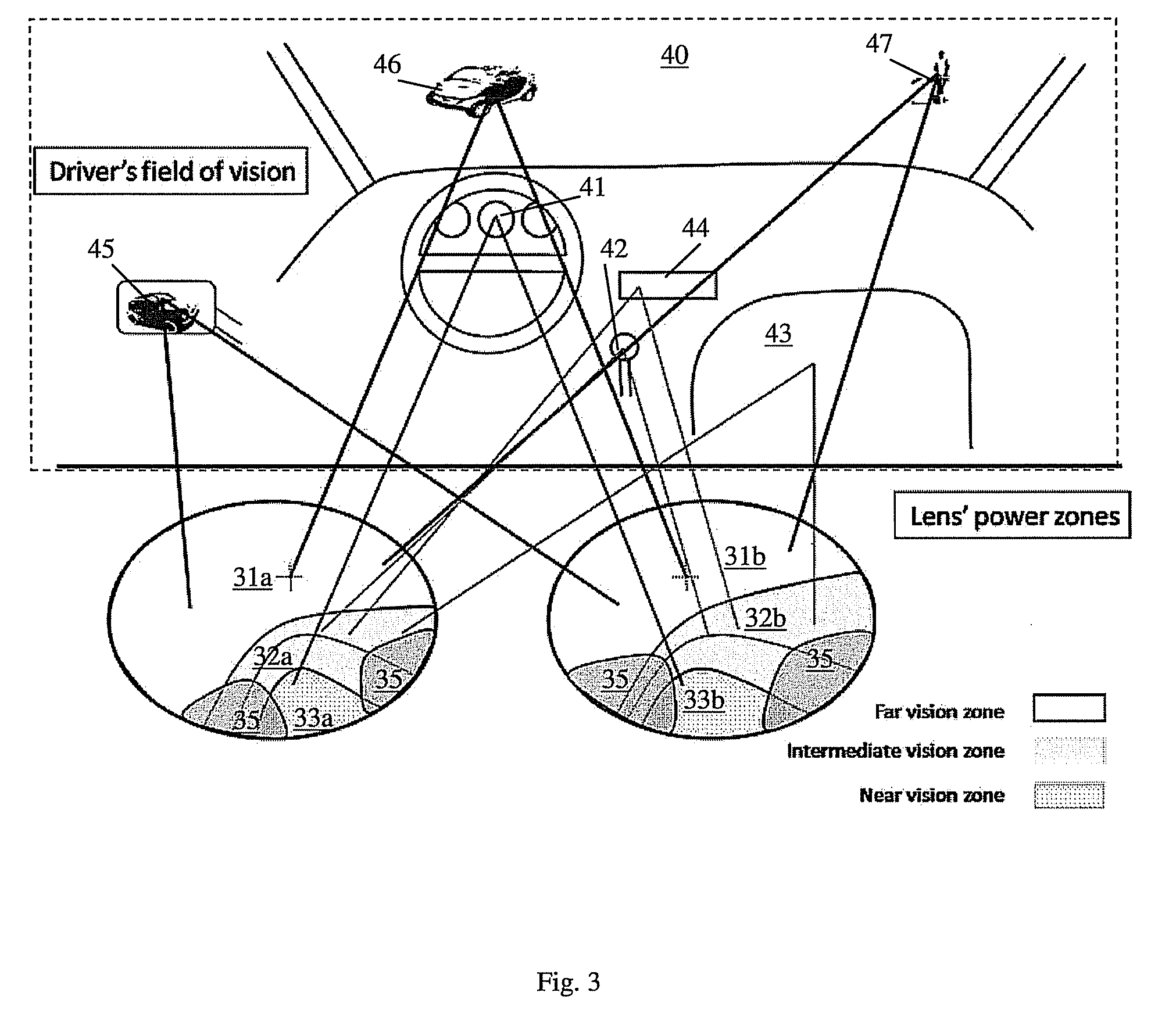 Assymetrical progressive lens