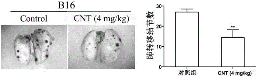 Application of carboxylated multiwalled carbon nanotube to preparation of anti-tumor metastasis medicine