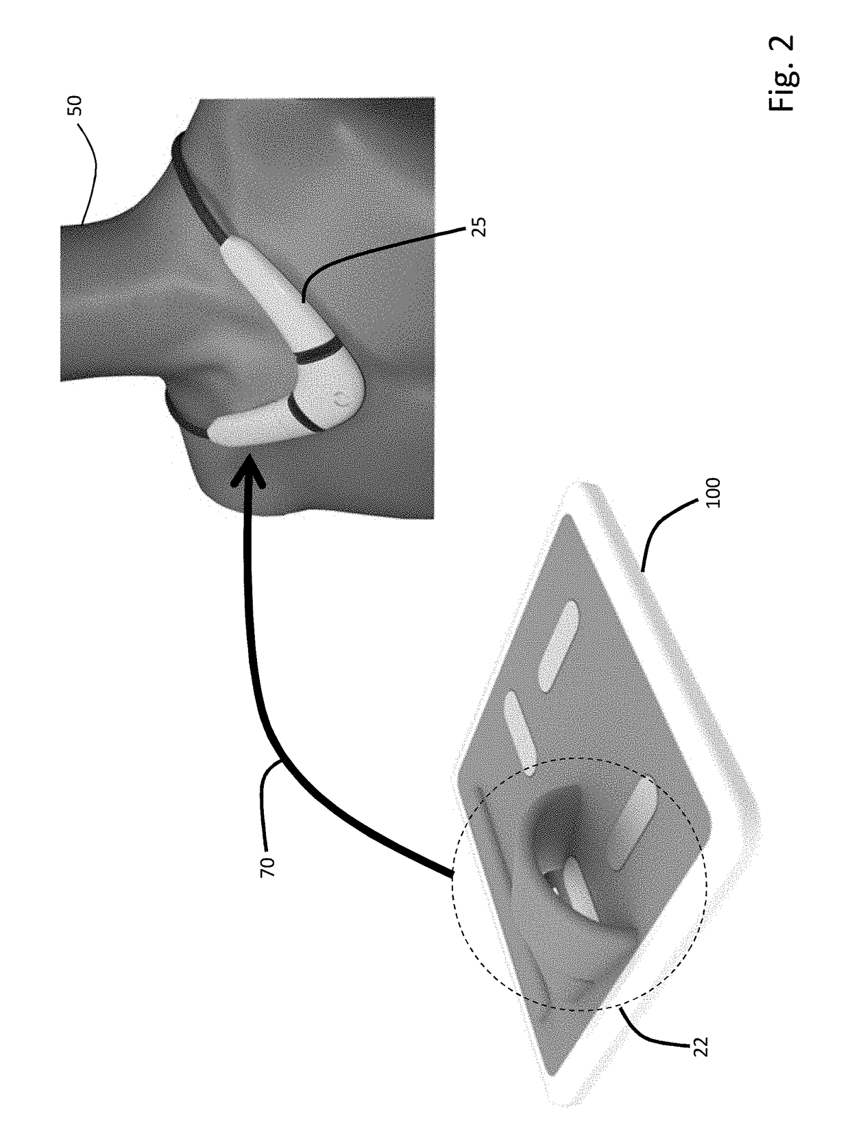 Combined floormat and body-worn physiological sensors