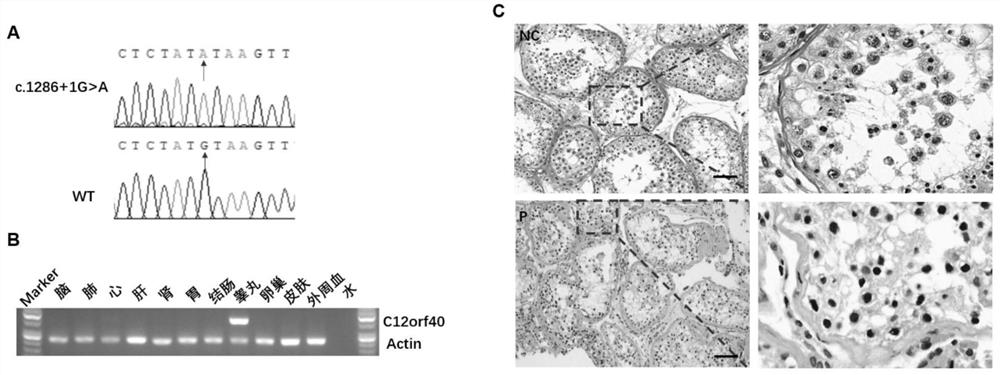 Application of C12orf40 gene