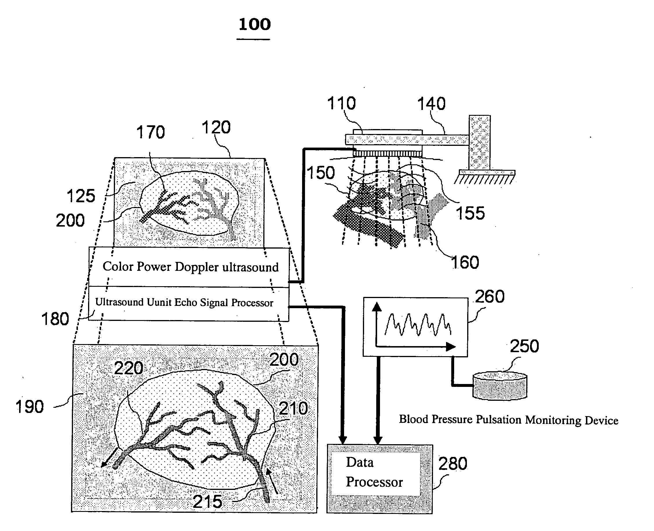 Quantitative non-invasive method for detecting degree of malignancy in tumors and application thereof