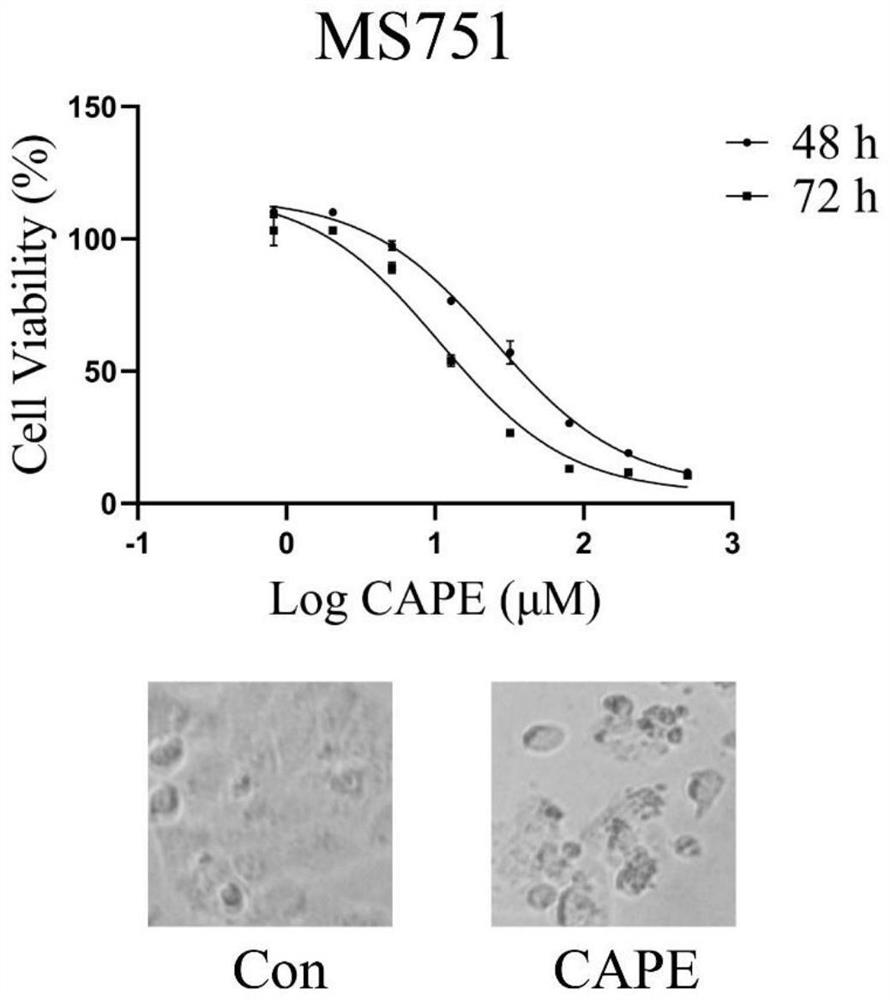 Application of phenethyl caffeate in preparation of anti-cervical cancer drugs