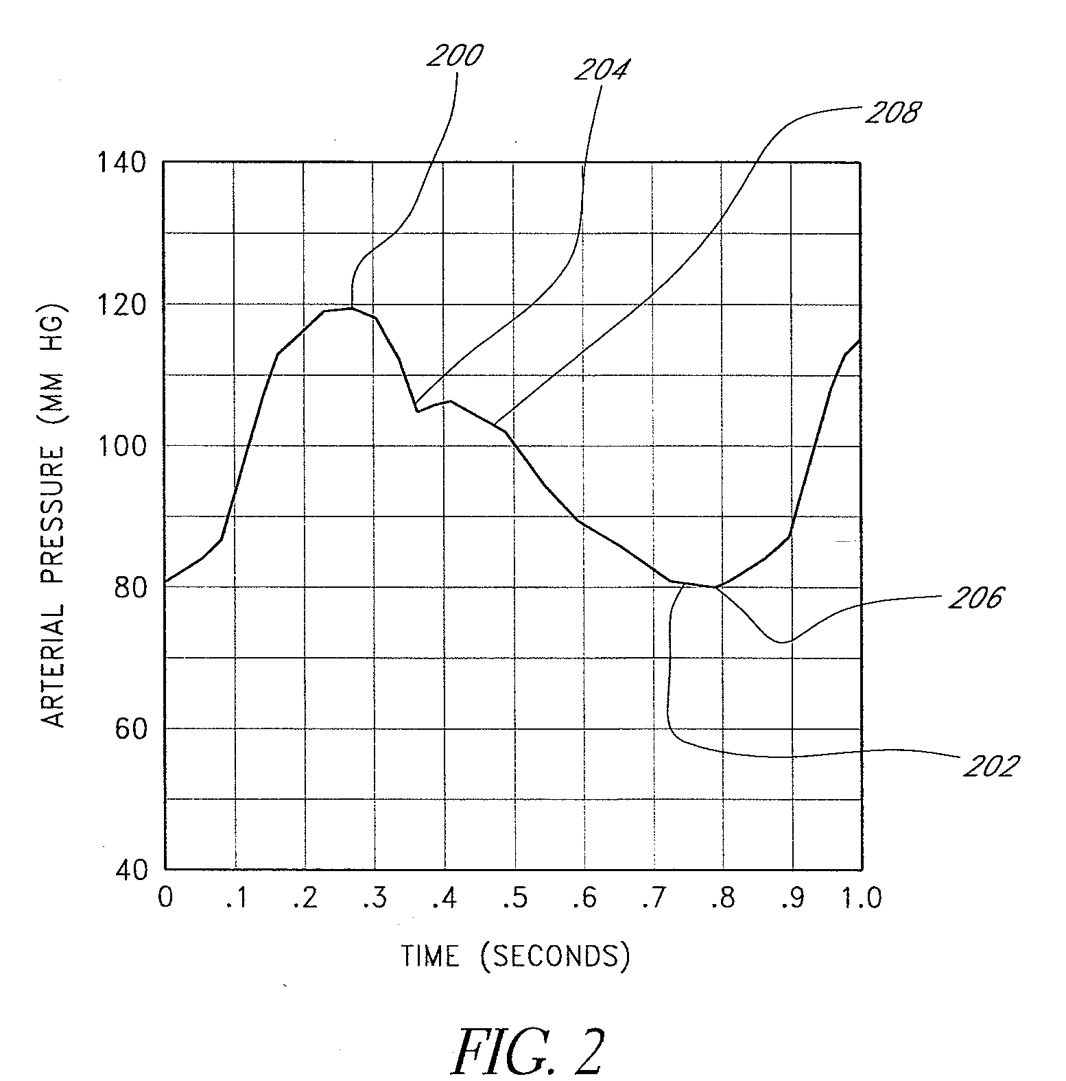 Endovascular catheter air block