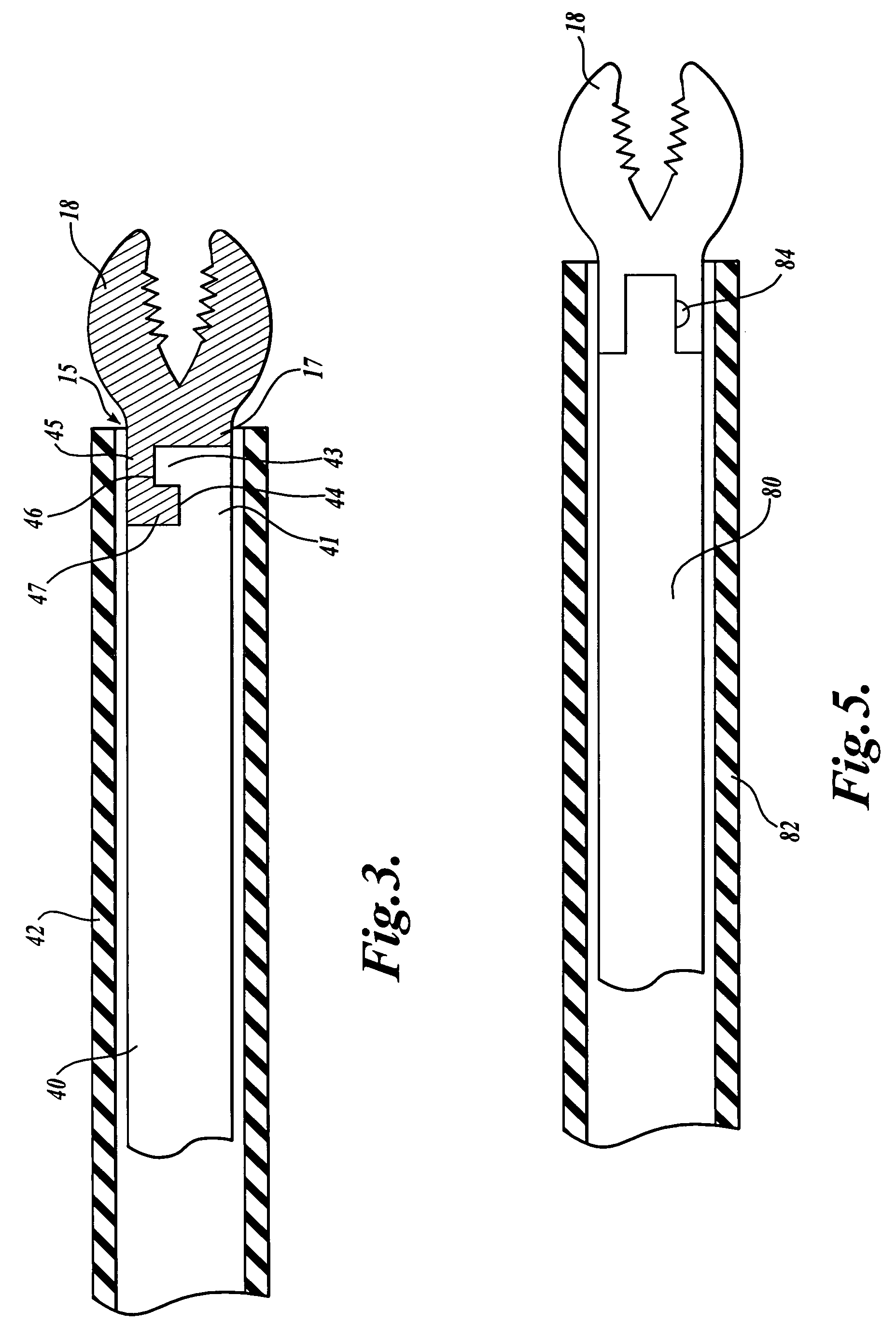 Biopsy forceps with removable jaw segments