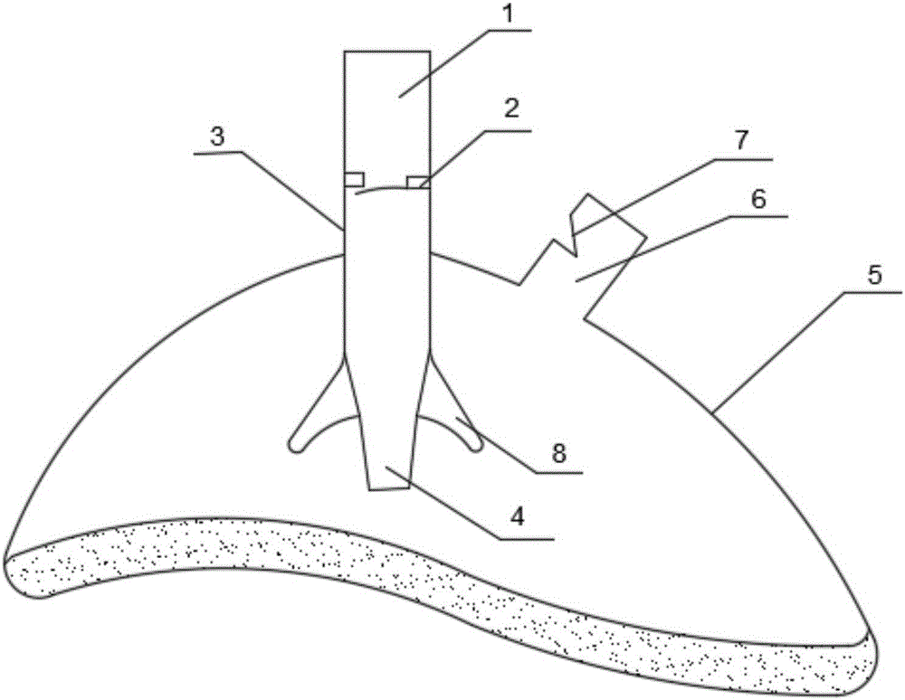 Artificial respiration blowing nozzle