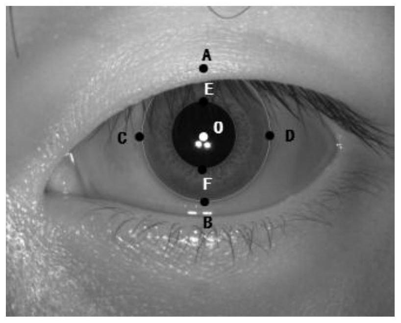 Fast eyelid detection method and system based on gabor filter