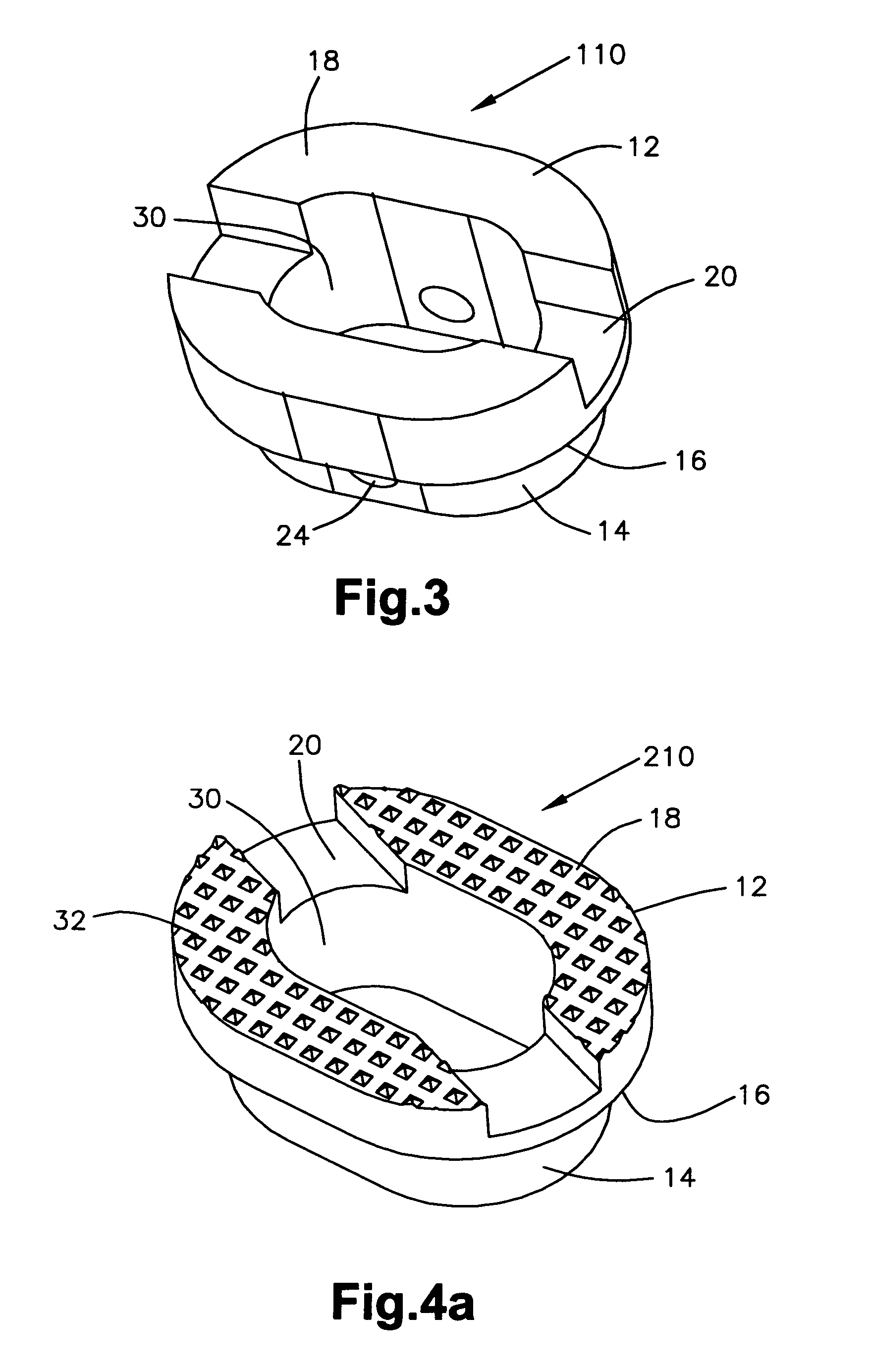 End member for a bone fusion implant