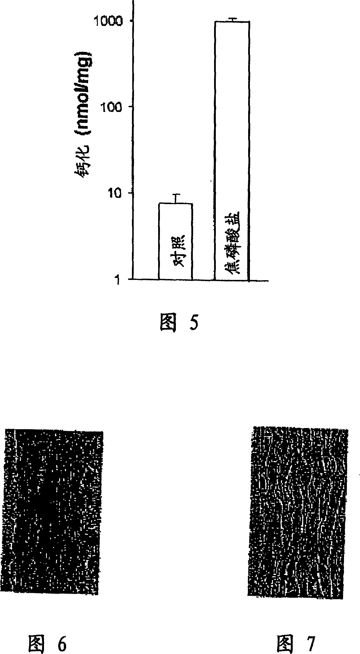 Dialysates and methods and systems related thereto