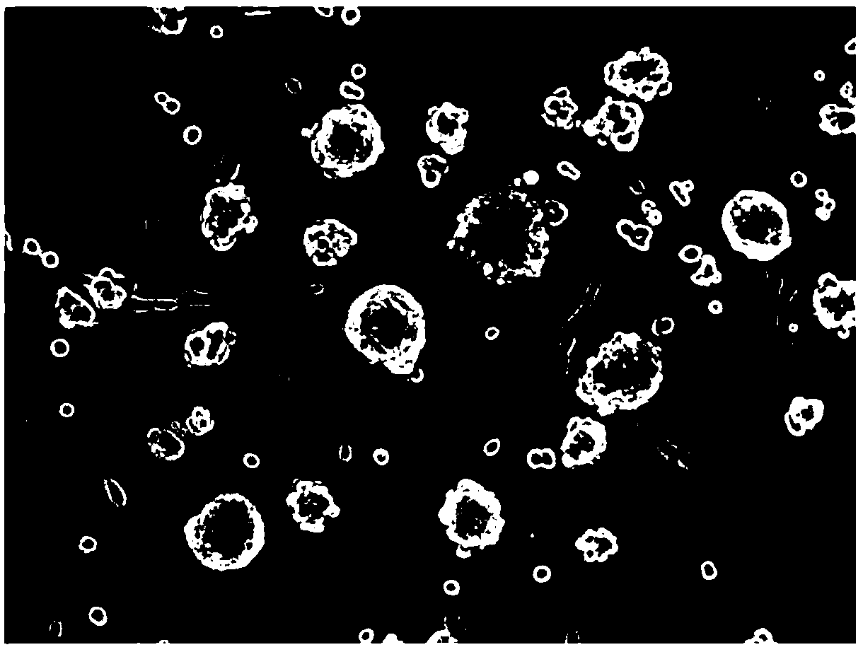 Method for inducing differentiation of human skin-derived precursor cells into corneal endothelial-like cells