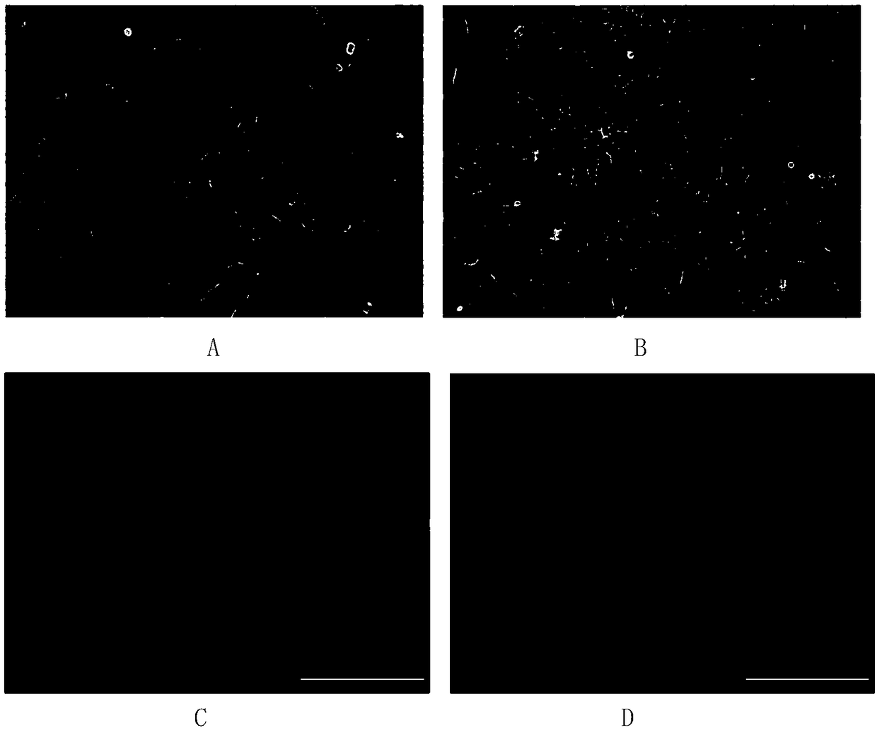 Method for inducing differentiation of human skin-derived precursor cells into corneal endothelial-like cells