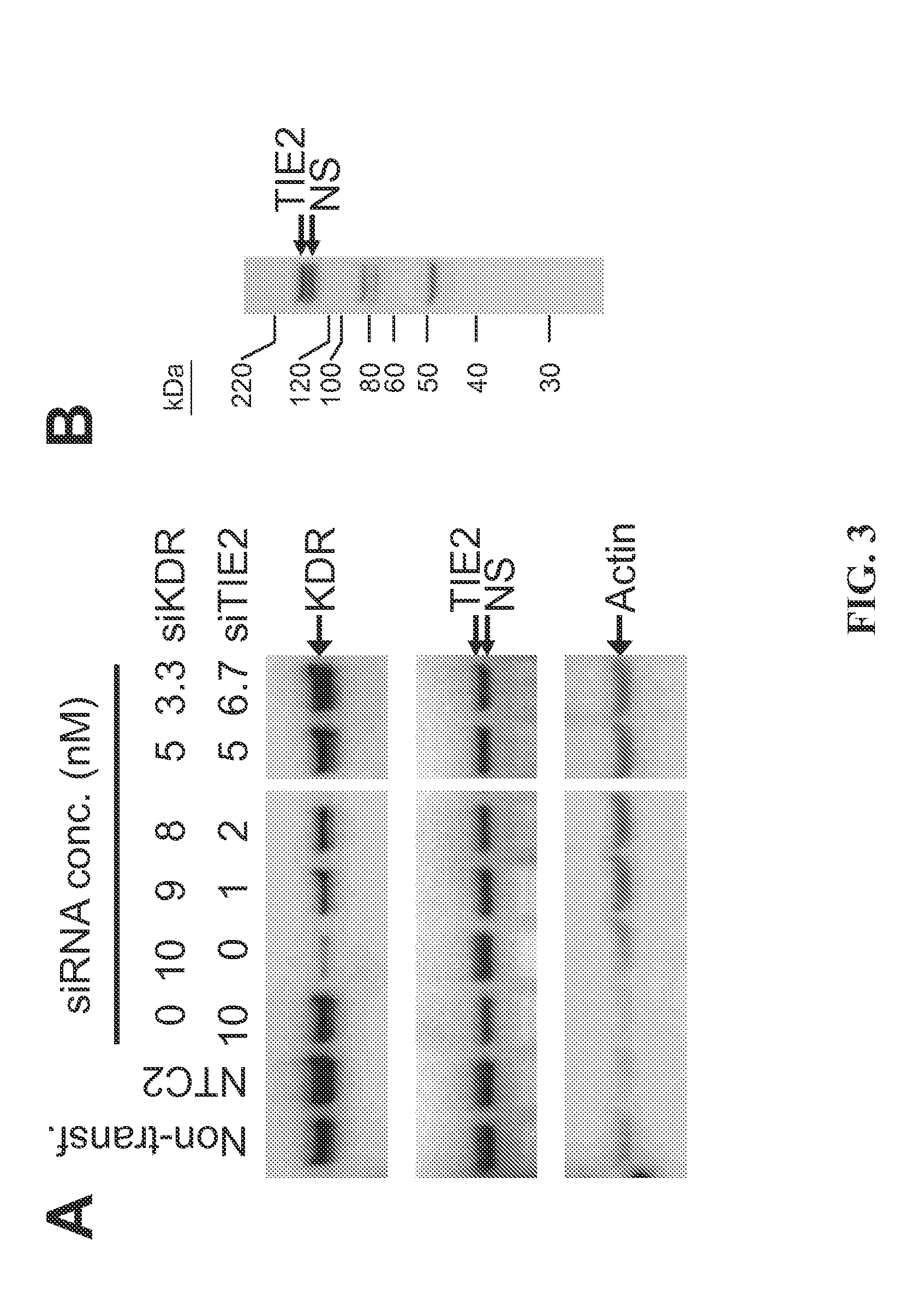 RNAi-MEDIATED INHIBITION OF SELECT RECEPTOR TYROSINE KINASES FOR TREATMENT OF PATHOLOGIC OCULAR NEOVASCULARIZATION-RELATED CONDITIONS