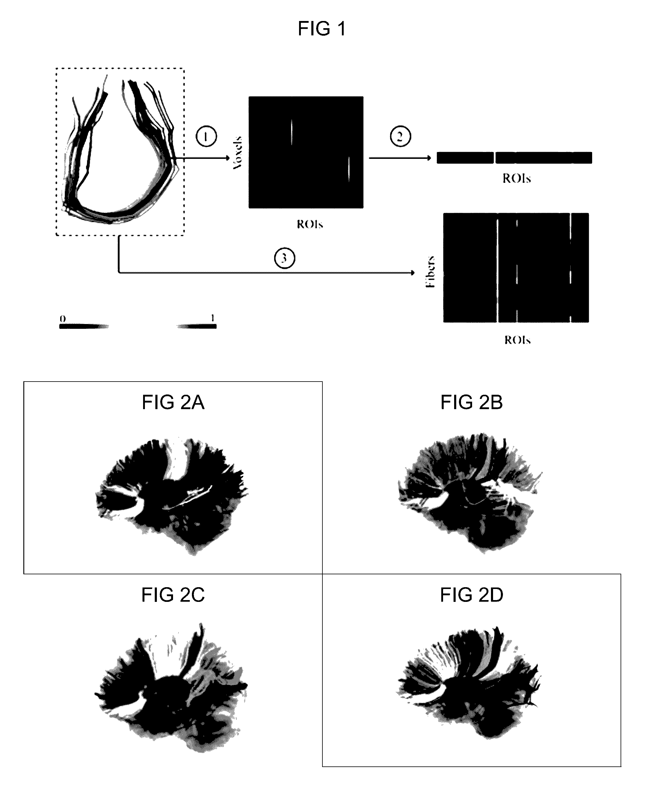 Automatic tract extraction via atlas based adaptive connectivity-based clustering