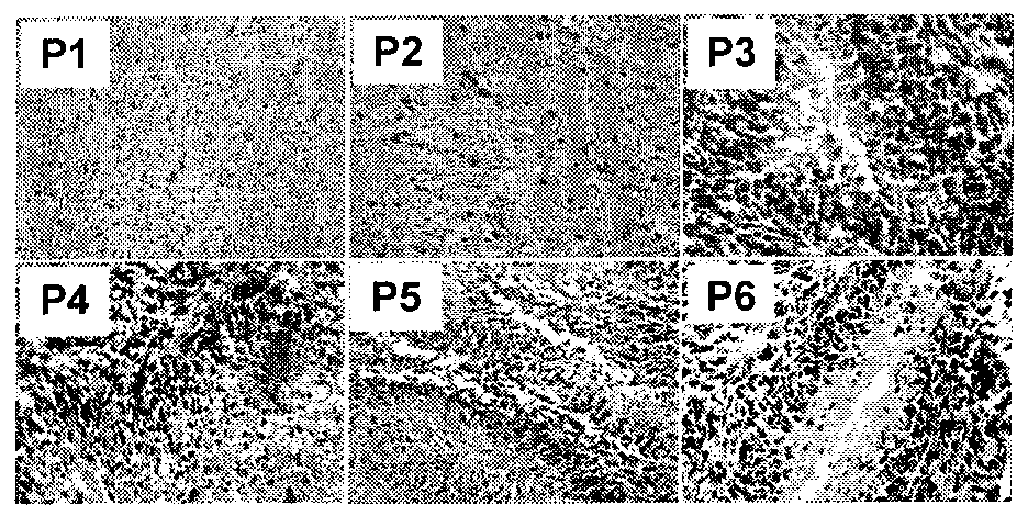 Application of gap junction protein and coding gene thereof in preparing medicament for reversing malignant phenotype of cancer stem cell