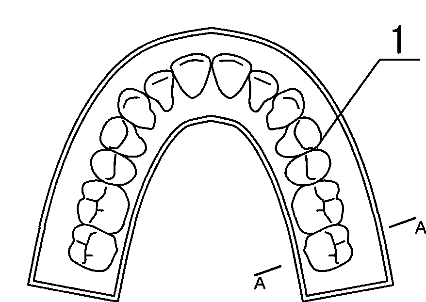 Method for producing macromolecule orthodontic tooth crown