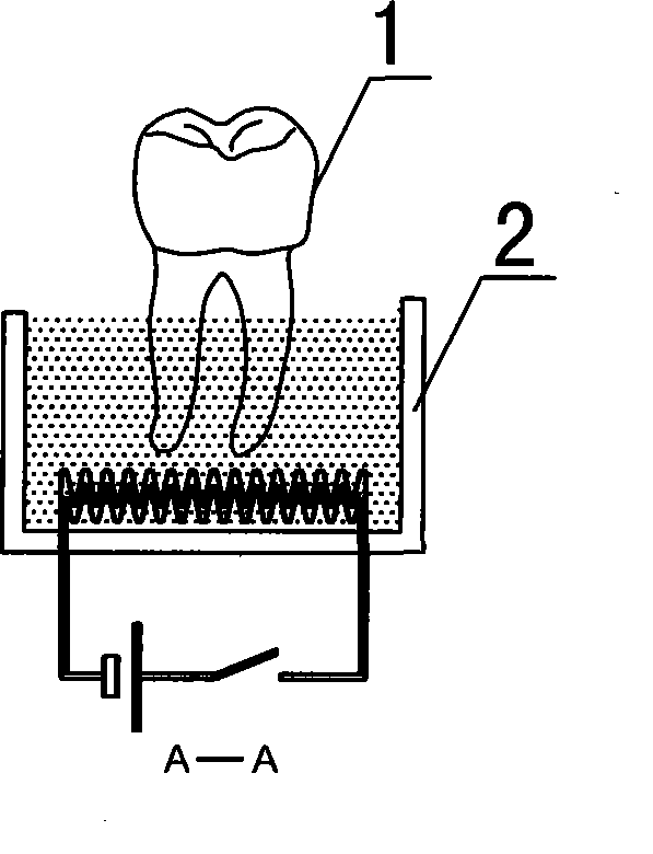 Method for producing macromolecule orthodontic tooth crown