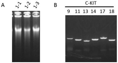 Primer combination and its application for detecting c-kit gene mutation in trace tissue