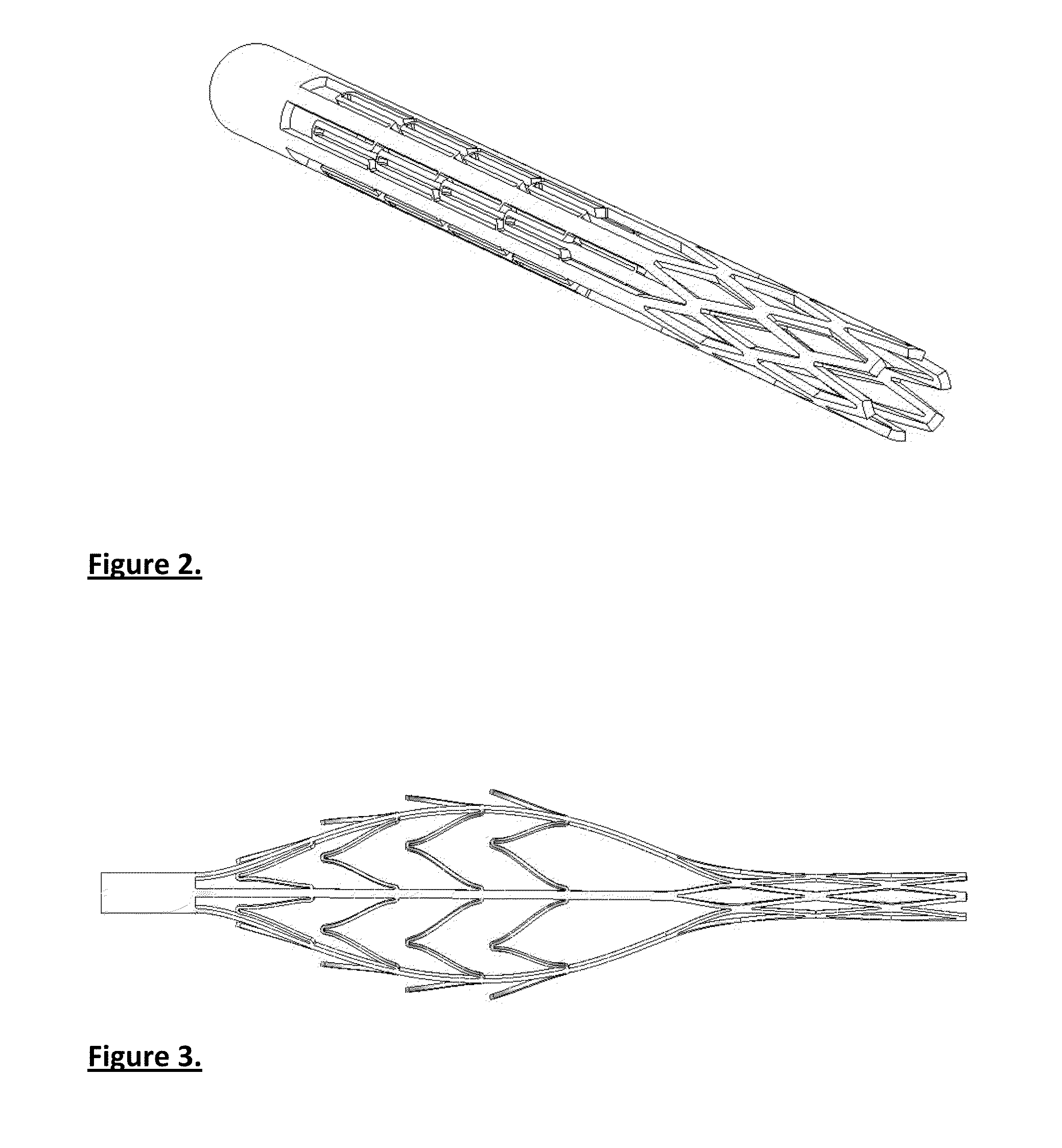 Device suitable for removing matter from inside the lumen and the wall of a body lumen