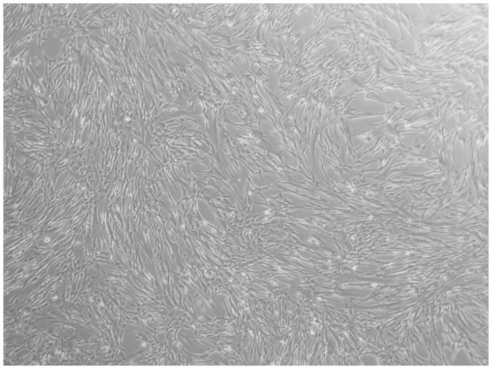 Cryopreservation liquid and cryopreservation method for long-term preservation of stem cells and stem cell products