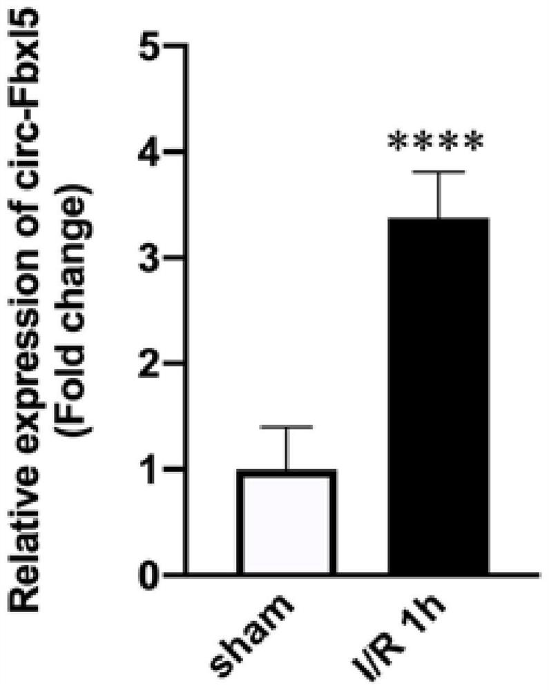 A myocardial ischemia-reperfusion injury marker circRNA and its application