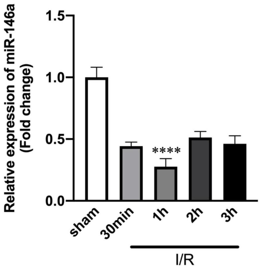 A myocardial ischemia-reperfusion injury marker circRNA and its application