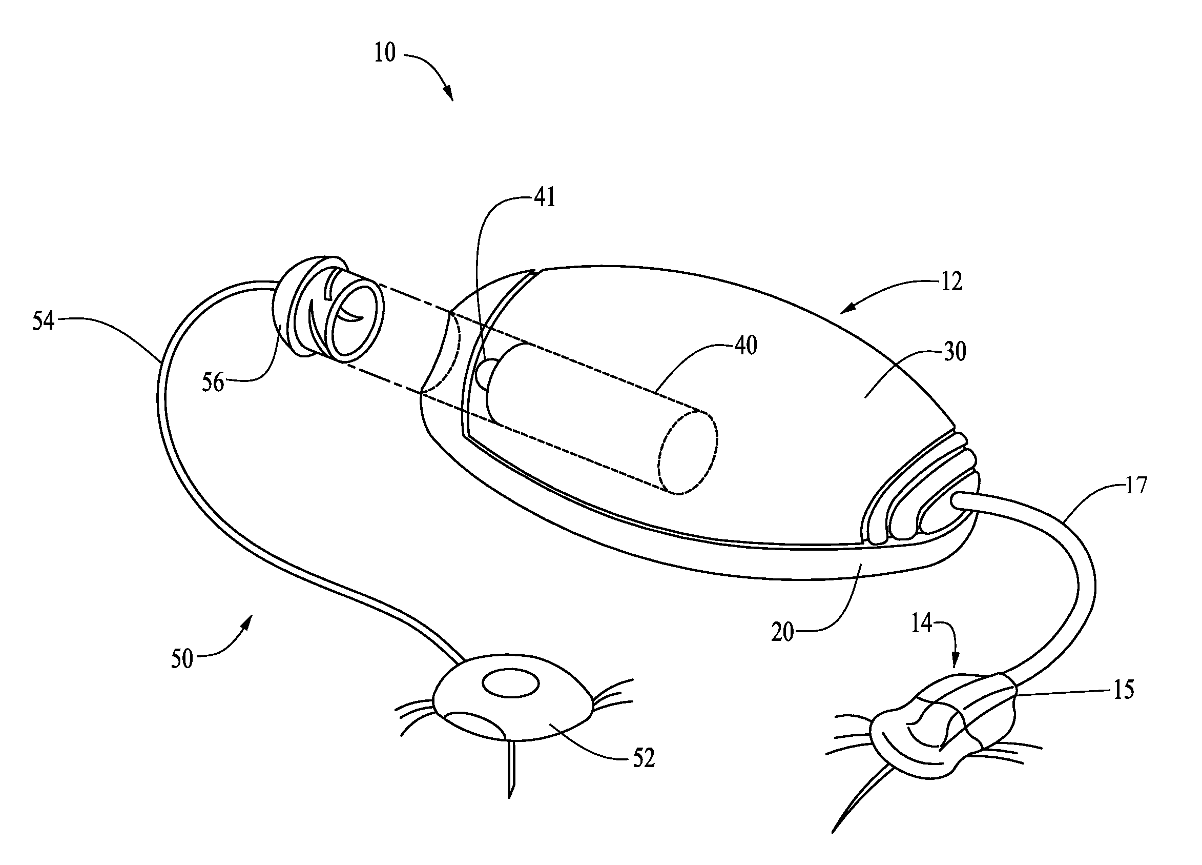 Connection and alignment detection systems and methods