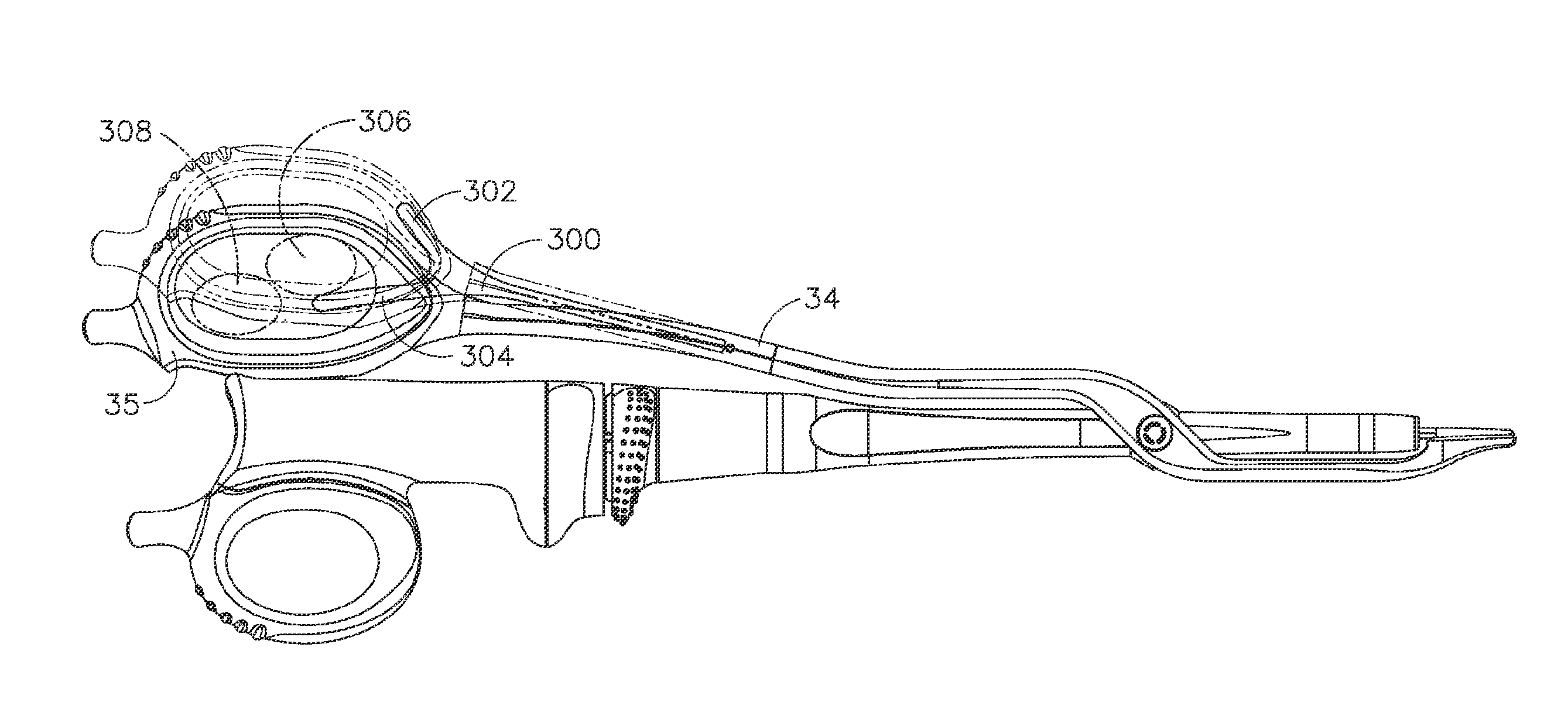 Ultrasonic device for cutting and coagulating