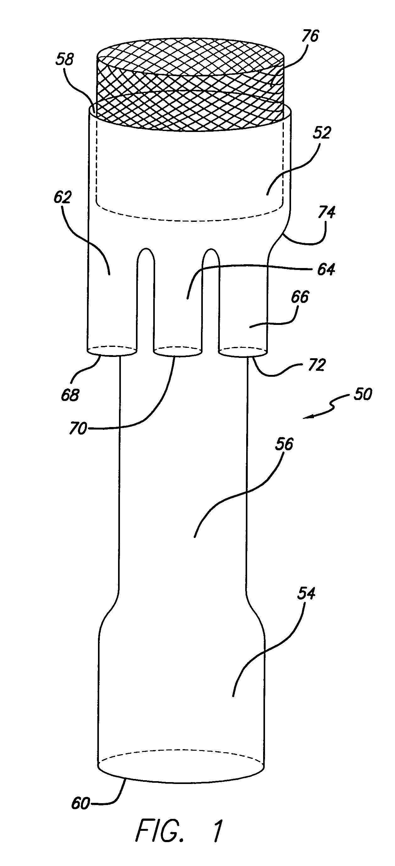 Modular grafting system and method