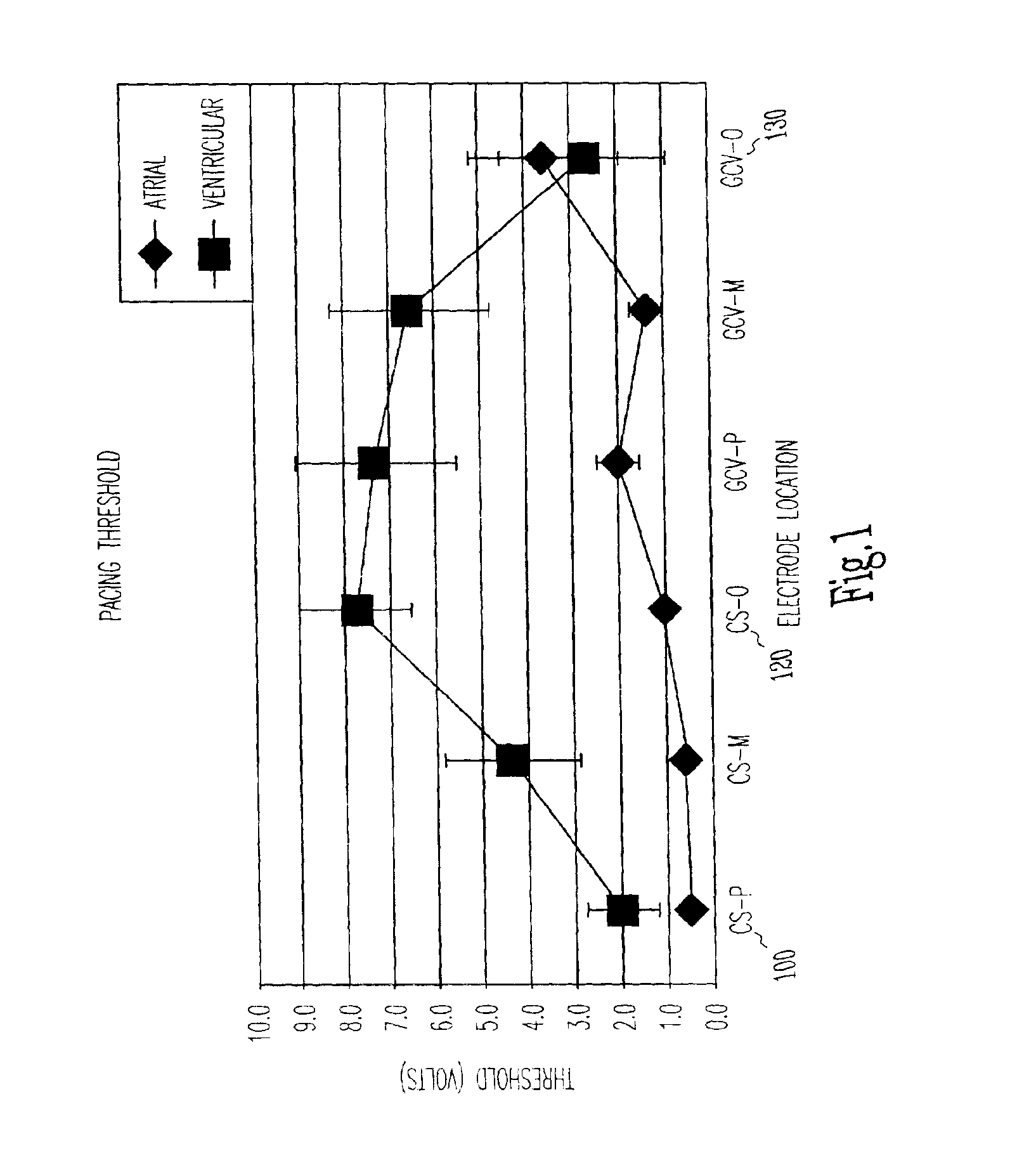 Cardiac rhythm management system and method