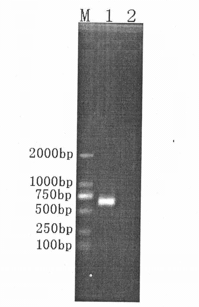 Method and reagent kit for simultaneously detecting resistance site of three nucleotide analogues of hepatitis B virus