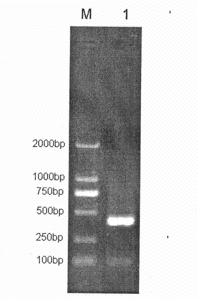 Method and reagent kit for simultaneously detecting resistance site of three nucleotide analogues of hepatitis B virus