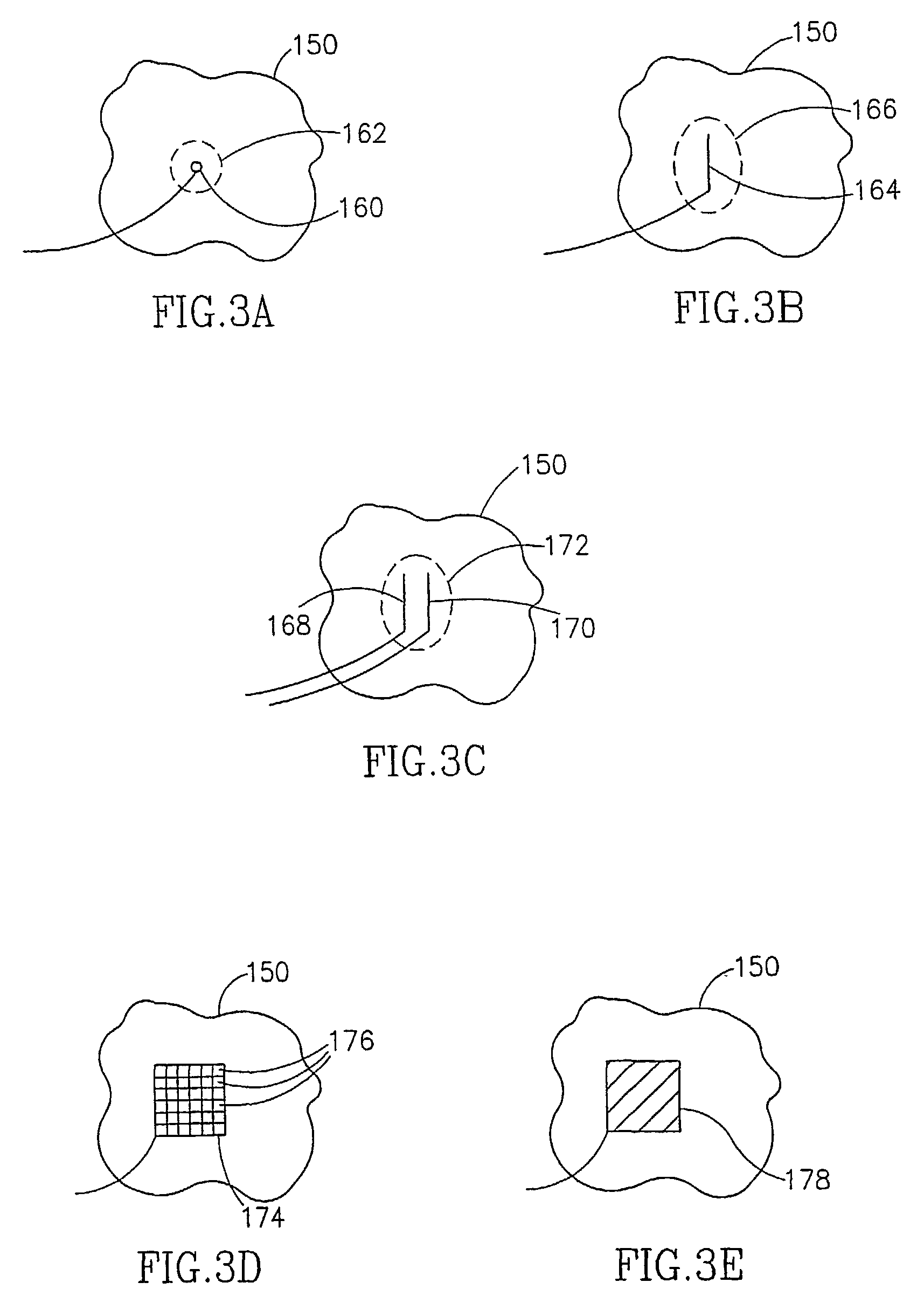 Drug delivery device