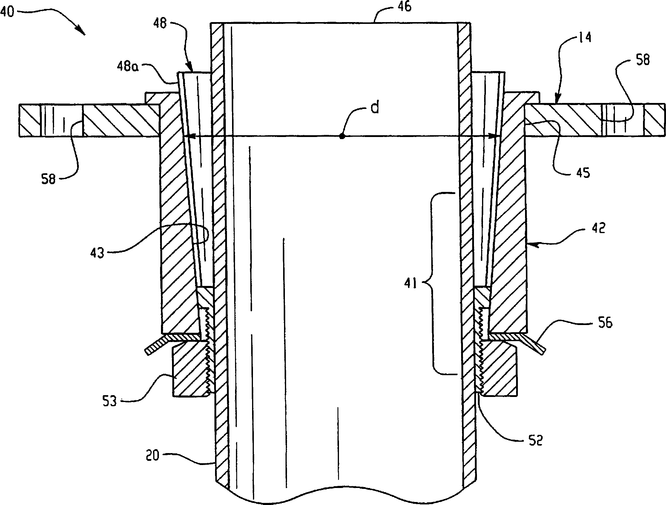 Surgical suspension system